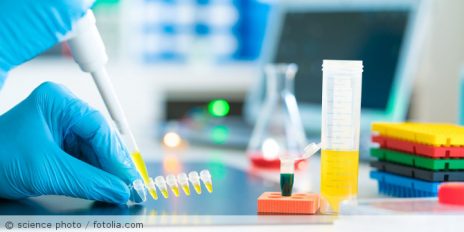 Eine Person im Labor die eine Pipette in der Hand hält.