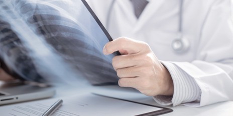 Arzt hält ein Röntgenbild von seinem Patienten in seinen Händen.