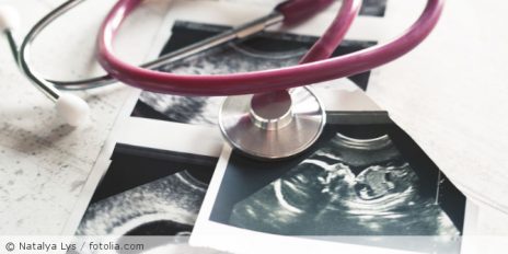 Ultraschallbild von einem Baby.