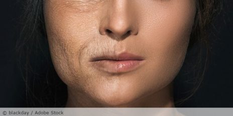 Frau bei der die eine Gesichtshälfte Falten hat und die andere nicht.