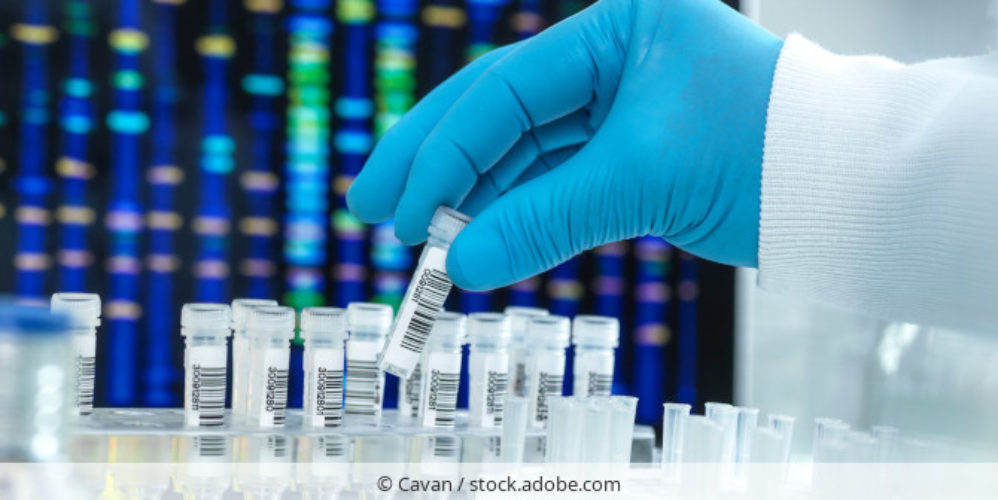 Labor_Hand_Proben_AdobeStock_450842152