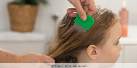 Einem kleinen Mädchen werden die Haare mit einem Läusekamm durchgekämmt.