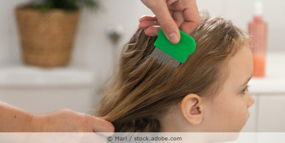 Einem kleinen Mädchen werden die Haare mit einem Läusekamm durchgekämmt.